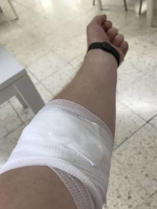 Andere Kategorie als ein bloßes Pflaster: Rund zwei bis drei Stunden soll dieser Verband getragen werden, um etwaige Nachblutungen zu verhindern.